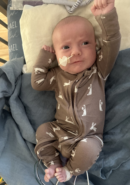 Elijah after craniofacial surgery at CHRISTUS Children's